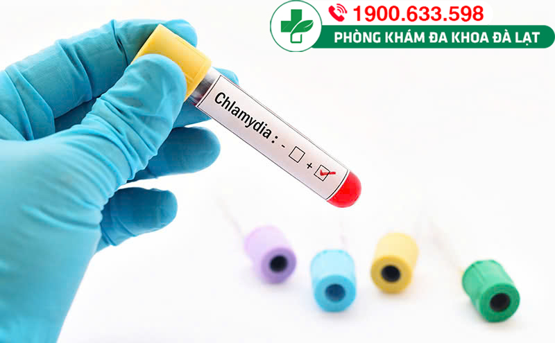 Hình ảnh minh họa